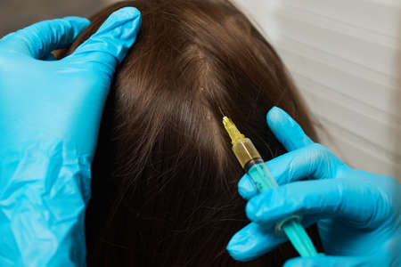 Plasma treatment, plasmolifting or PRP method point the introduction of the patients own plasma enriched with platelets, in the problem areas of the skin.の写真素材