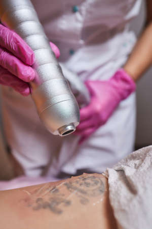 Young woman undergoing laser tattoo removal procedure in salon, closeup.の写真素材