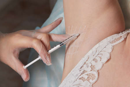 The doctor makes intramuscular injections of botulinum toxin.の写真素材