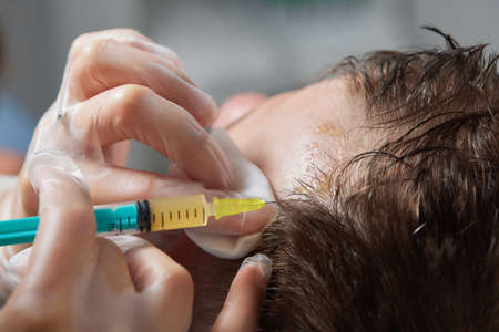 Injection plasma into head hair man cosmetologist doctor.の写真素材