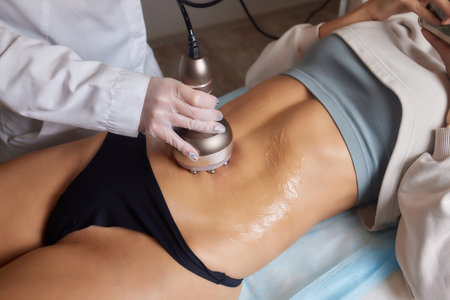 procedure removing cellulite on female abdomen, cavitation belly massage. Ultrasonic massage for weight loss. Correction of female figure without surgical intervention. Closeup of the tummy.の写真素材