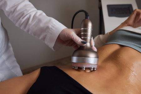 procedure removing cellulite on female abdomen, cavitation belly massage. Ultrasonic massage for weight loss. Correction of female figure without surgical intervention. Closeup of the tummy.の写真素材