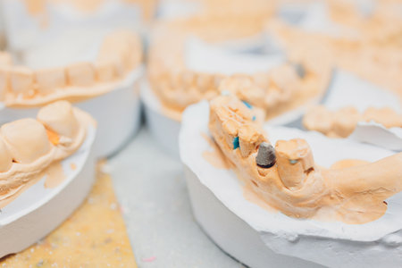 The process of making a dental prosthesis in a dental laboratory.