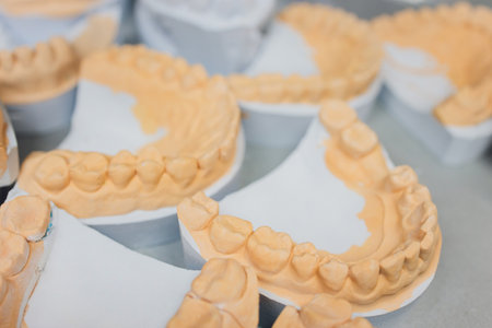 The process of making a dental prosthesis in a dental laboratory.の写真素材