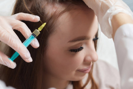 Plasma treatment, plasmolifting or PRP method point the introduction of the patients own plasma enriched with platelets, in the problem areas of the skin.の写真素材