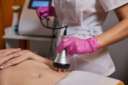 Rf skin tightening, belly. Hand of cosmetician, female body. Non surgical body sculpting.の写真素材