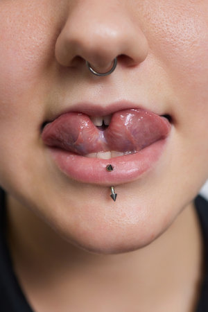 tongue splitting. cutting the tongue, one type of modification of the human body. surgery concept.の写真素材
