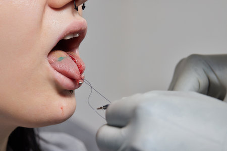 tongue splitting. cutting the tongue, one type of modification of the human body. surgery concept.の写真素材