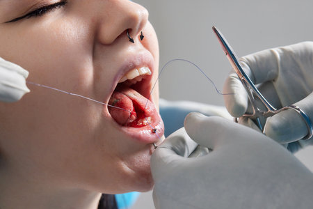 tongue splitting. cutting the tongue, one type of modification of the human body. surgery concept.