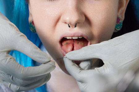 tongue splitting. cutting the tongue, one type of modification of the human body. surgery concept.