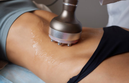 procedure removing cellulite on female abdomen, cavitation belly massage. Ultrasonic massage for...