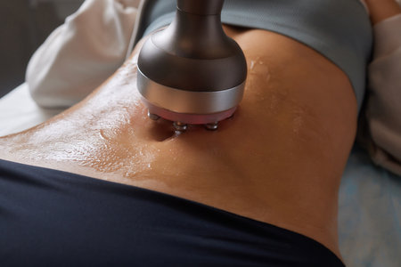 procedure removing cellulite on female abdomen, cavitation belly massage. Ultrasonic massage for weight loss. Correction of female figure without surgical intervention. Closeup of the tummy.の写真素材
