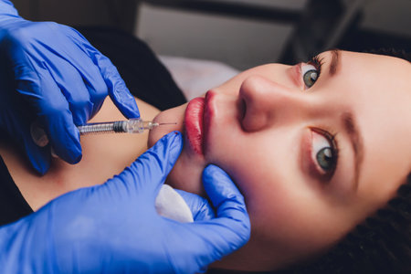 Young woman receiving a injection in her lips, close up.の写真素材