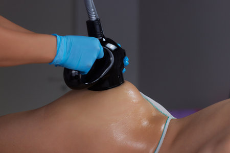 procedure removing cellulite on female abdomen, cavitation belly massage. Ultrasonic massage for weight loss. Correction of female figure without surgical intervention. Closeup of the tummyの写真素材