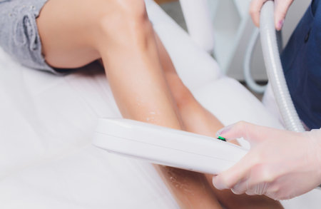 Laser epilation of leg in a modern beauty shop.の写真素材