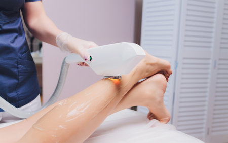 Laser epilation of leg in a modern beauty shop.の写真素材