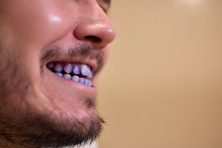 A man with blue teeth looks amused in a closeup shot, with a spontaneous and vibrant expression Plaque indicator tabletsの写真素材