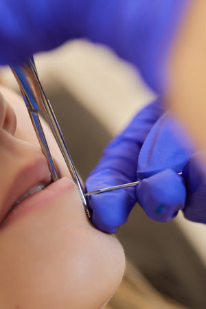 smile or frenulum piercing under the upper lip.の写真素材