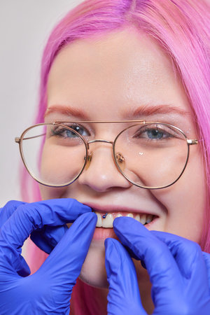 Girl lower lip piercing. Labret piercing. Macro. Blue ball.