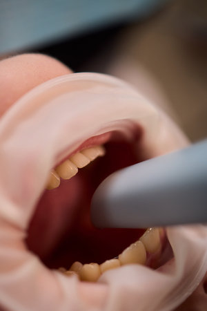 The Advanced Ultrasound Procedure is a vital component in modern medical practice and healthcare...
