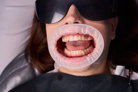 Dental Treatment Procedure that involves exposing teeth for proper examination and careの写真素材