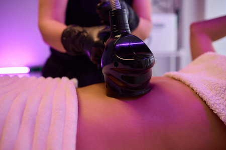 In a clinical setting, a medical device is utilized for therapy or treatment purposesの写真素材