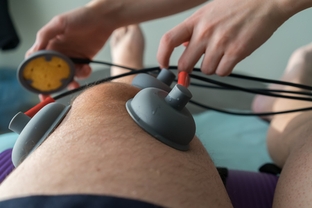 suction cups applied to a knee in physiotherapyの写真素材