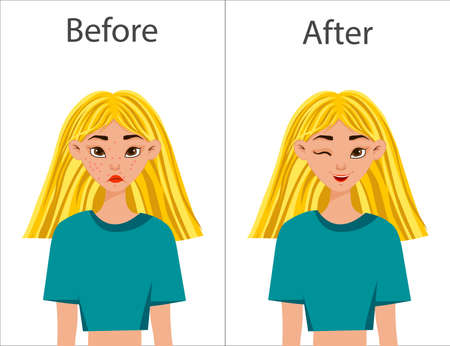 Girl before and after acne treatment. Cartoon style.のイラスト素材