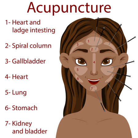 Dark-skinned girl with an acupuncture scheme of facial zones. Cartoon style. Vector illustrationのイラスト素材