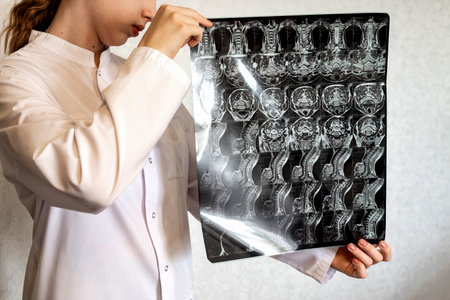 A healthcare worker in surgical attire closely analyzes a series of MRI scans displayed against a...