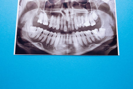 Close-up panoramic shot of the jaw. Dentistry and dental treatment.