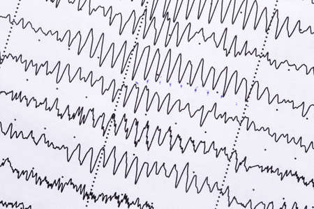 Cardiogram on a sheet of paper close-up. Texture of pulsed waves.の写真素材