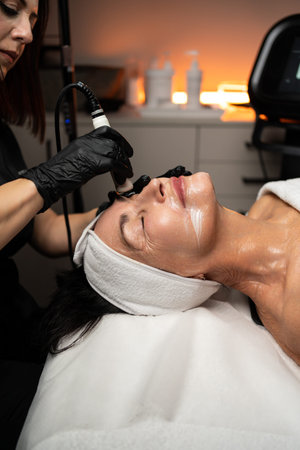 Woman undergoing advanced skin rejuvenation procedure performed by an esthetician, improving facial...