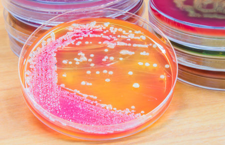 Bacterial culture growth on agar plate; contains small light grains,pink and white colonies.