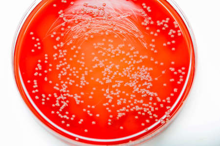 Bacterial colonies culture on Blood agar(gram positive cocci in clusters)contains small light grains. Focus on all agar surface.の写真素材