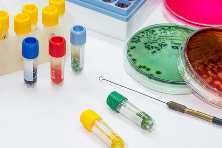 Microbank tubes for keep isolated pathogen in freezer, collurefull tubes, media and loop on write...