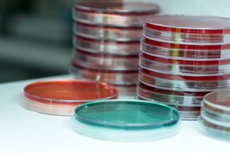 Xylose lysine deoxycholate agar (XLD agar) and thiosulphate-citrate-bile salts-sucrose(TCBS) agar.の写真素材