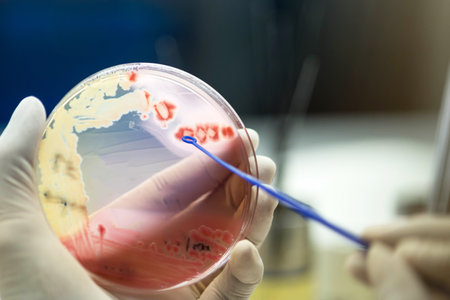 Close up the media plate on hand medical technicians working on bacterial culture and drug...