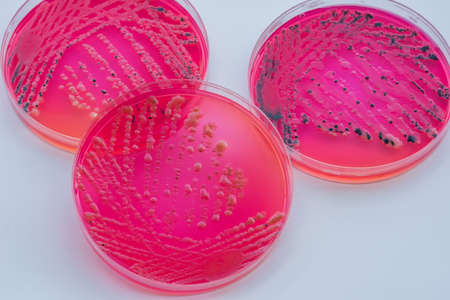 Bacterial colonies culture on  selective agar media XLT Agar (Xylose Lysine Tergitol) contains small light grains. Focus on all agar surface.の写真素材
