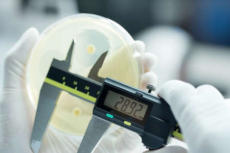Zone Size of bacteria as subsensitivity test on Mueller-Hinton agar plate contains small light grains in experimental laboratory Hospital.の写真素材