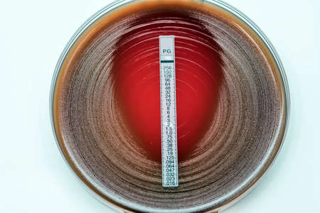 E-test penicillin for staphylococcus aureus/staphylococcus coagulase negative.の写真素材