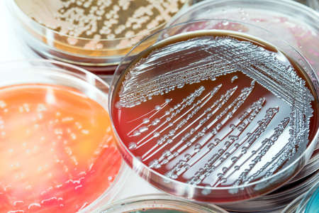 Bacterial culture growth on selective media.Gram positive and gram negative growth.の写真素材