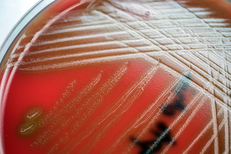 Streptococcus suis; Gram-positive, to Gram-variable, nonmotile, Coccus, saprotrophic bacterium that...