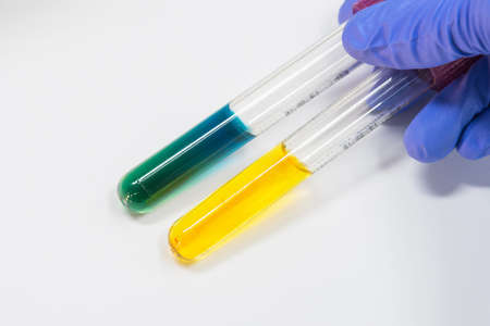 TSI positive and  negative  for biochem test for bacteria; biochemical research laboratory.の写真素材