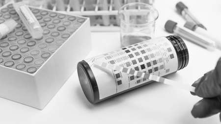 Reagent Strip for Urinalysis , Routine Urinalysis, urine test check-up analysis in laboratory.の写真素材