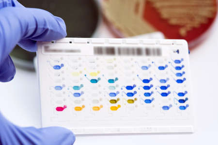 Reagent Strip for biochem and drug sensitivity test for identifield pathogen in routine microbiology,analysis and report in laboratory.の写真素材