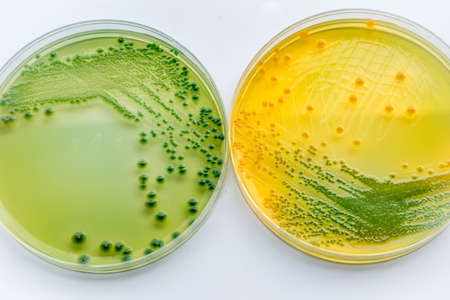 Comparison betaween Vibrio parahaemolyticus and Vibrio cholera : Gram-negative,comma-shaped bacterium  on macconkey agar.の写真素材