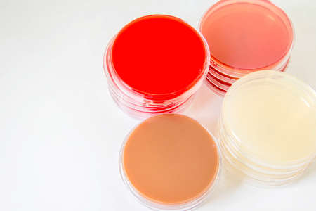 Blood agar(BA), Chocolate agar(CA), MacConkey agar(MAC), MU agar ; Selective Media for Bacteria growth.の写真素材