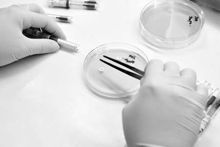 Close up the media plate on hand medical technicians working on bacterial culture and drug...