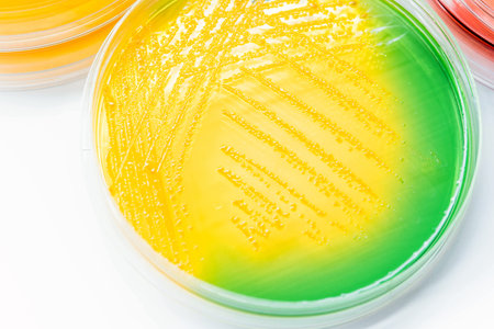 TCBS Agar (Thiosulfate Citrate Bile Salts Sucrose Agar) is recommended for the selective isolation...